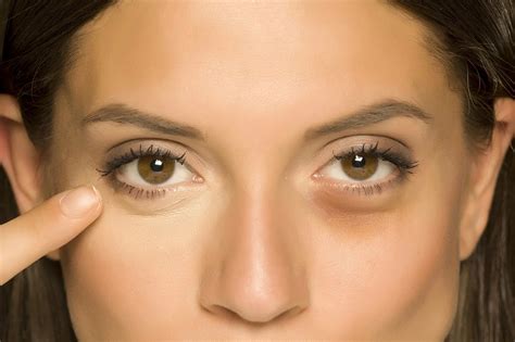 fake tan eye bags|purses under eyes.